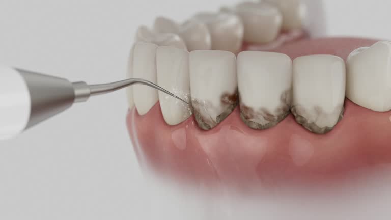 Reliable Emergency Dentist contractor in Foresthill, CA by Smile Center Dentistry